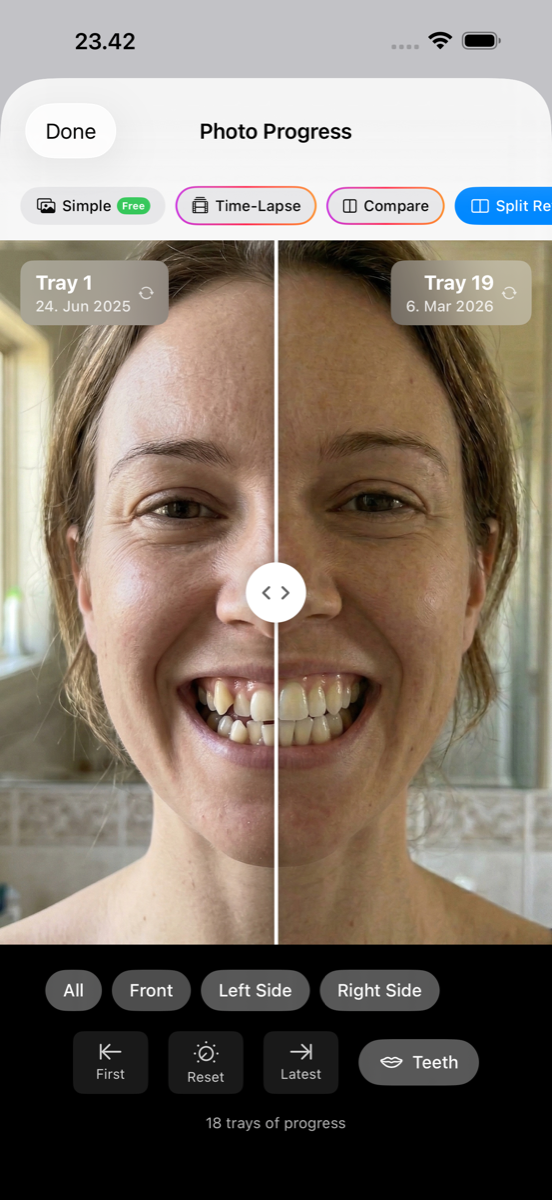 Before and after split reveal